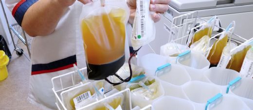 Aferez Trombosit Yöntemi Nasıl Yapılır?