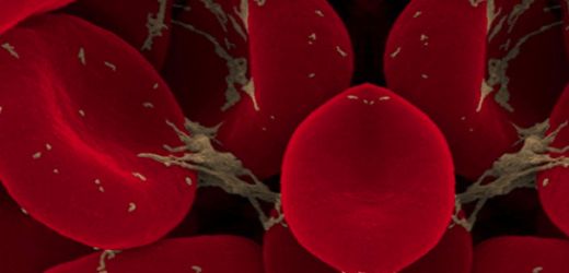 Kanda Trombosit Belirtileri ve Tedavisi