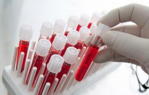 Trombosit Değerleri Nedir ve Kaç Olmalıdır?