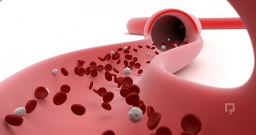 Yeni Doğan Bebeklerde Trombosit Düşüklüğü